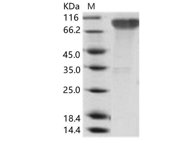 EBV (strain B95-8) GP350 Protein - Recombinant Epstein-Barr virus (Herpesvirus 4) EBV Glycoprotein gp350 / EBV GP350 Protein (His Tag)