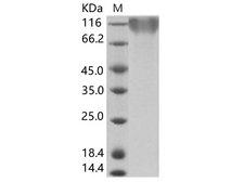 EBV (strain B95-8) GP350 Protein - Recombinant Epstein-Barr virus (Herpesvirus 4) EBV Glycoprotein gp350 / EBV GP350 Protein (His Tag)