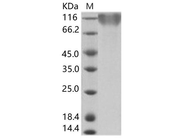 EBV (strain B95-8) GP350 Protein - Recombinant Epstein-Barr virus (Herpesvirus 4) EBV Glycoprotein gp350 / EBV GP350 Protein (His Tag)