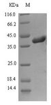 gH / Envelope Glycoprotein H Protein - (Tris-Glycine gel) Discontinuous SDS-PAGE (reduced) with 5% enrichment gel and 15% separation gel.