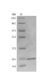 LMP2 Protein - (Tris-Glycine gel) Discontinuous SDS-PAGE (reduced) with 5% enrichment gel and 15% separation gel.