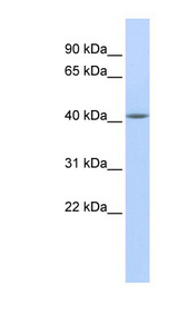 EPSTI1 Antibody - EPSTI1 antibody Western blot of MCF7 cell lysate. This image was taken for the unconjugated form of this product. Other forms have not been tested.