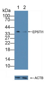 EPSTI1 Antibody - Knockout Varification: Lane 1: Wild-type MCF7 cell lysate; Lane 2: EPSTI1 knockout MCF7 cell lysate; Predicted MW: 35,37,47kd Observed MW: 37kd Primary Ab: 2µg/ml Rabbit Anti-Human EPSTI1 Antibody Second Ab: 0.2µg/mL HRP-Linked Caprine Anti-Rabbit IgG Polyclonal Antibody