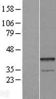 EPSTI1 Protein - Western validation with an anti-DDK antibody * L: Control HEK293 lysate R: Over-expression lysate
