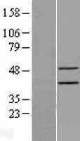 EPSTI1 Protein - Western validation with an anti-DDK antibody * L: Control HEK293 lysate R: Over-expression lysate