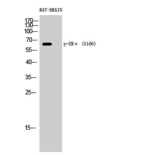 ER Alpha / Estrogen Receptor Antibody - Western blot of Phospho-ERalpha (S106) antibody