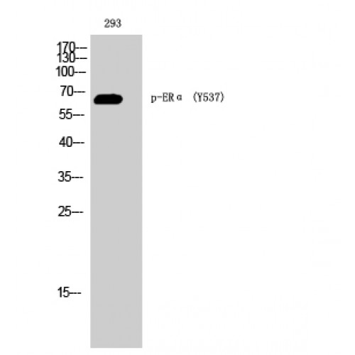 ER Alpha / Estrogen Receptor Antibody - Western blot of Phospho-ERalpha (Y537) antibody