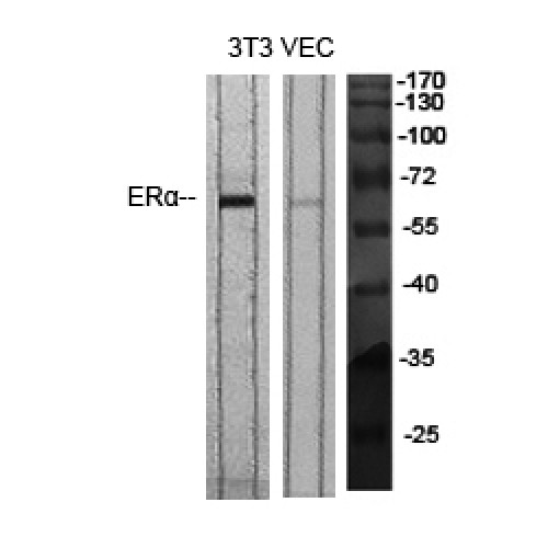 ER Alpha / Estrogen Receptor Antibody - Western blot of ERalpha antibody