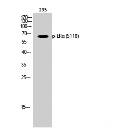 ER Alpha / Estrogen Receptor Antibody - Western blot of Phospho-ERalpha (S118) antibody