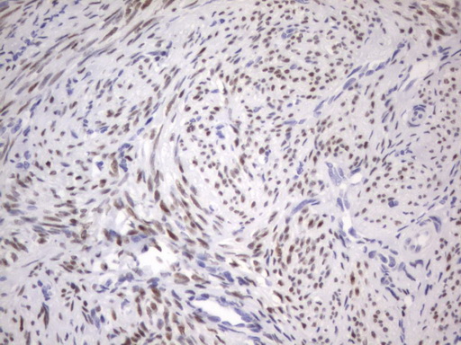 ER Alpha / Estrogen Receptor Antibody - IHC of paraffin-embedded Human endometrium tissue using anti-ESR1 mouse monoclonal antibody. (Heat-induced epitope retrieval by 1 mM EDTA in 10mM Tris, pH8.5, 120°C for 3min).