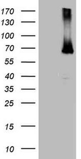 ER Alpha / Estrogen Receptor Antibody - HEK293T cells were transfected with the pCMV6-ENTRY control. (Left lane) or pCMV6-ENTRY ESR1. (Right lane) cDNA for 48 hrs and lysed. Equivalent amounts of cell lysates. (5 ug per lane) were separated by SDS-PAGE and immunoblotted with anti-ESR1.