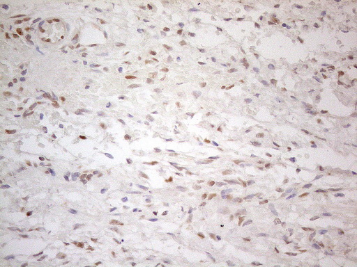 ER Alpha / Estrogen Receptor Antibody - Immunohistochemical staining of paraffin-embedded Human Ovary tissue using anti-ESR1 mouse monoclonal antibody. (Heat-induced epitope retrieval by 1mM EDTA in 10mM Tris buffer. (pH8.5) at 120°C for 3 min. (1:150)
