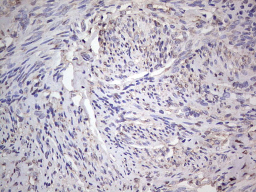 ER Alpha / Estrogen Receptor Antibody - Immunohistochemical staining of paraffin-embedded Human endometrium tissue using anti-ESR1 mouse monoclonal antibody.