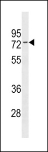 ER Alpha / Estrogen Receptor Antibody - ESR1 isoform1 Antibody western blot of 293 cell line lysates (35 ug/lane). The ESR1 isoform1 antibody detected the ESR1 isoform1 protein (arrow).