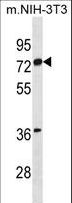 ER Alpha / Estrogen Receptor Antibody - ESR1 isoform1 Antibody western blot of mouse NIH-3T3 cell line lysates (35 ug/lane). The ESR1 isoform1 antibody detected the ESR1 isoform1 protein (arrow).