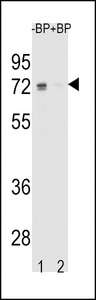 ER Alpha / Estrogen Receptor Antibody - Western blot of ESR1 isoform1 Antibody antibody pre-incubated without(lane 1) and with(lane 2) blocking peptide in K562 cell line lysate. ESR1 isoform1 Antibody (arrow) was detected using the purified antibody.