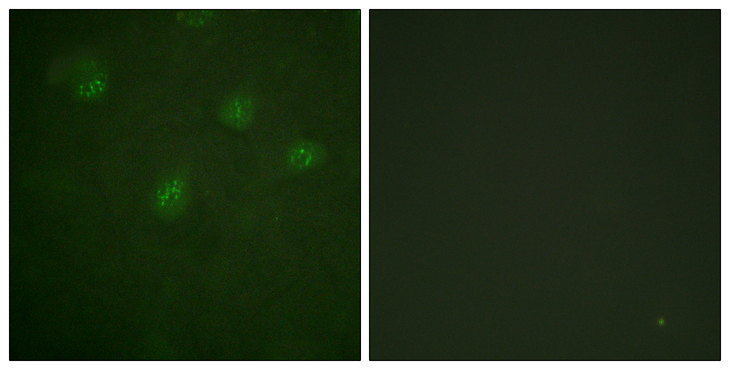 ER Alpha / Estrogen Receptor Antibody - Immunofluorescence analysis of A549 cells, using Estrogen Receptor-alpha Antibody. The picture on the right is blocked with the synthesized peptide.