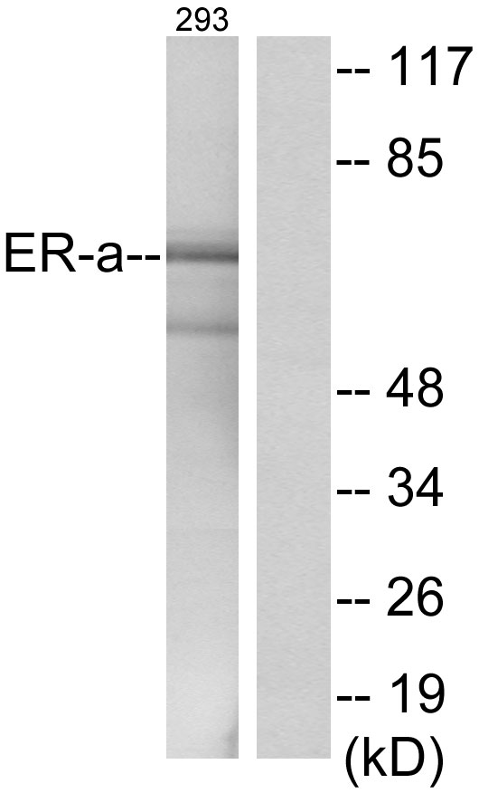 ER Alpha / Estrogen Receptor Antibody - Western blot analysis of lysates from 293 cells, using Estrogen Receptor-alpha Antibody. The lane on the right is blocked with the synthesized peptide.