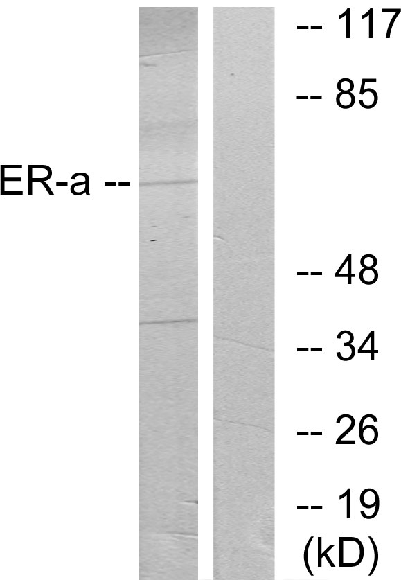 ER Alpha / Estrogen Receptor Antibody - Western blot analysis of lysates from MCF7 cells, treated with Estradiol, using Estrogen Receptor-alpha Antibody. The lane on the right is blocked with the synthesized peptide.