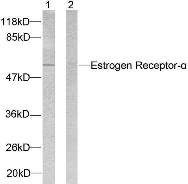ER Alpha / Estrogen Receptor Antibody - Western blot analysis of lysates from 293 cells, treated with Forskolin, using Estrogen Receptor-alpha Antibody. The lane on the right is blocked with the synthesized peptide.