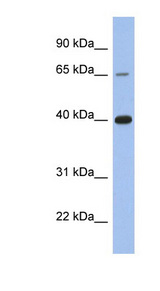 ER Alpha / Estrogen Receptor Antibody - ESR1 / Estrogen Receptor antibody Western blot of ACHN lysate. This image was taken for the unconjugated form of this product. Other forms have not been tested.