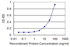 ER Alpha / Estrogen Receptor Antibody - Detection limit for recombinant GST tagged ESR1 is 1 ng/ml as a capture antibody.