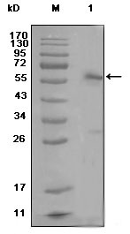 ER Alpha / Estrogen Receptor Antibody - Western blot using ESR1 mouse monoclonal antibody against MCF-7 cell lysate (1)