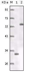 ER Alpha / Estrogen Receptor Antibody - Western blot using ER mouse monoclonal antibody truncated ER recombinant protein (1) MCF-7 cell lysates (2).