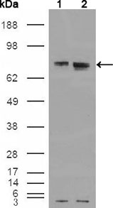 ER Alpha / Estrogen Receptor Antibody - Western blot using ER mouse monoclonal antibody against HEK293T cells transfected with the pCMV6-ENTRY control (1) and pCMV6-ENTRY ER cDNA (2).