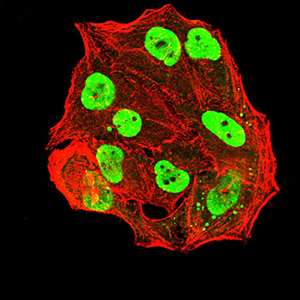 ER Alpha / Estrogen Receptor Antibody - Immunofluorescence analysis of Hela cells using ESR1 mouse mAb (green). Blue: DRAQ5 fluorescent DNA dye. Red: Actin filaments have been labeled with Alexa Fluor- 555 phalloidin. Secondary antibody from Fisher