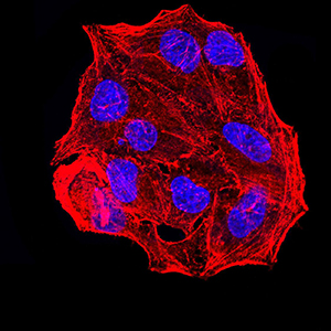 ER Alpha / Estrogen Receptor Antibody - Immunofluorescence analysis of Hela cells using ESR1 mouse mAb. Blue: DRAQ5 fluorescent DNA dye. Red: Actin filaments have been labeled with Alexa Fluor- 555 phalloidin.