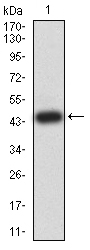 ER Alpha / Estrogen Receptor Antibody - Western blot analysis using ESR1 mAb against human ESR1 (AA: 2-185) recombinant protein. (Expected MW is 45.8 kDa)