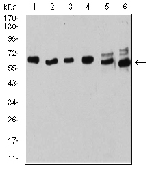 ER Alpha / Estrogen Receptor Antibody - Western blot analysis using ESR1 mouse mAb against MOLT4 (1), Raji (2), MCF-7 (3), T47D (4), SK-Br-3 (5), and Hela (6) cell lysate.