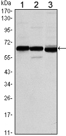 ER Alpha / Estrogen Receptor Antibody - Western blot using ESR1 mouse monoclonal antibody against MCF-7 (1), T47D (2) and SKBR3 (3) cell lysate.