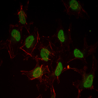 ER Alpha / Estrogen Receptor Antibody - Immunofluorescence of HeLa cells using ESR1 mouse monoclonal antibody (green). Red: Actin filaments have been labeled with Alexa Fluor-555 phalloidin.