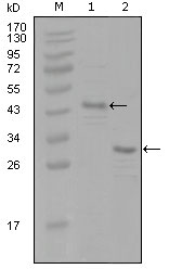 ER Alpha / Estrogen Receptor Antibody - Western blot using ESR1 mouse monoclonal antibody against truncated Trx-ESR1 recombinant protein (1) and truncated ESR1(aa130-339)-His recombinant protein (2).