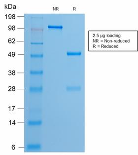 ER Alpha / Estrogen Receptor Antibody - SDS-PAGE Analysis of Purified Estrogen Receptor, alpha Rabbit Recombinant Monoclonal Antibody (ESR1/2299R). Confirmation of Purity and Integrity of Antibody.