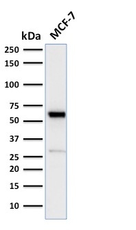 ER Alpha / Estrogen Receptor Antibody - Western Blot Analysis of human MCF-7 Cell lysate using Estrogen Receptor, alpha Rabbit Recombinant Monoclonal Antibody (ESR1/2299R).