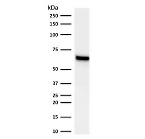 ER Alpha / Estrogen Receptor Antibody - Western blot testing of human MCF-7 lysate with Estrogen Receptor alpha antibody (clone NR3Ga-2). Expected molecular weight ~67 kDa.