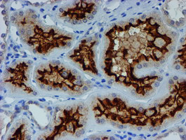 ER Alpha / Estrogen Receptor Antibody - IHC of paraffin-embedded Human Kidney tissue using anti-ESR1 mouse monoclonal antibody.