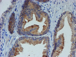 ER Alpha / Estrogen Receptor Antibody - IHC of paraffin-embedded Human prostate tissue using anti-ESR1 mouse monoclonal antibody.