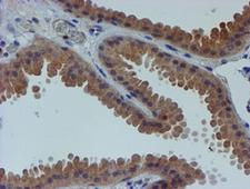 ER Alpha / Estrogen Receptor Antibody - IHC of paraffin-embedded Human breast tissue using anti-ESR1 mouse monoclonal antibody.
