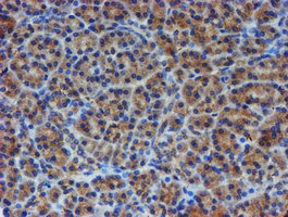 ER Alpha / Estrogen Receptor Antibody - IHC of paraffin-embedded Human pancreas tissue using anti-ESR1 mouse monoclonal antibody.