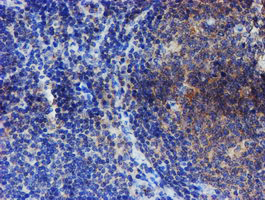 ER Alpha / Estrogen Receptor Antibody - IHC of paraffin-embedded Human tonsil using anti-ESR1 mouse monoclonal antibody.