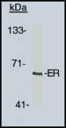 ER Alpha / Estrogen Receptor Antibody - Western blot of estrogen receptor antibody on human cells at 1-2 ug/ml.