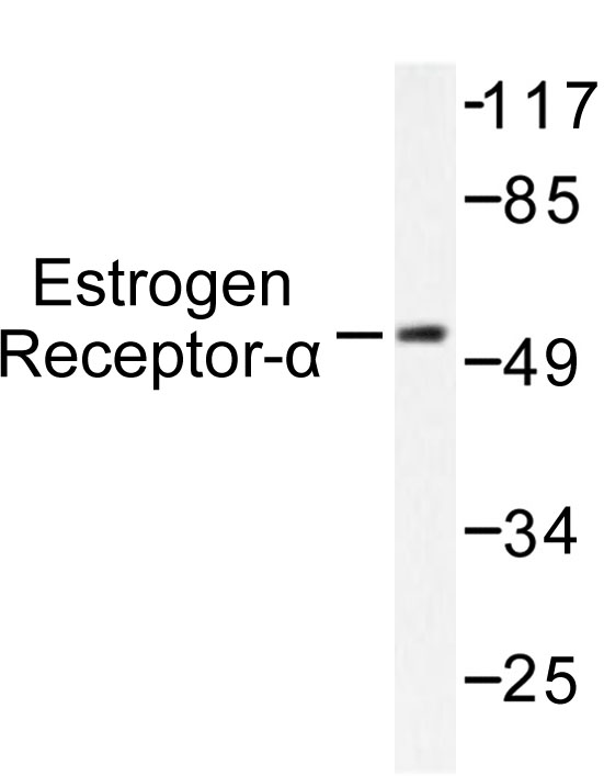 ER Alpha / Estrogen Receptor Antibody - Western blot of Estrogen Receptor- (H112) pAb in extracts from MCF7 cells treated with Estradiol.