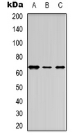 ER Alpha / Estrogen Receptor Antibody - Western blot analysis of Estrogen Receptor alpha expression in HUVEC (A); HepG2 (B); COLO205 (C) whole cell lysates.