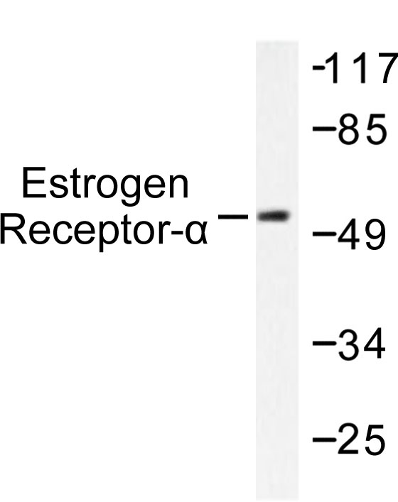 ER Alpha / Estrogen Receptor Antibody - Western blot of Estrogen Receptor- (L100) pAb in extracts from MCF7 cells treated with Estradiol.