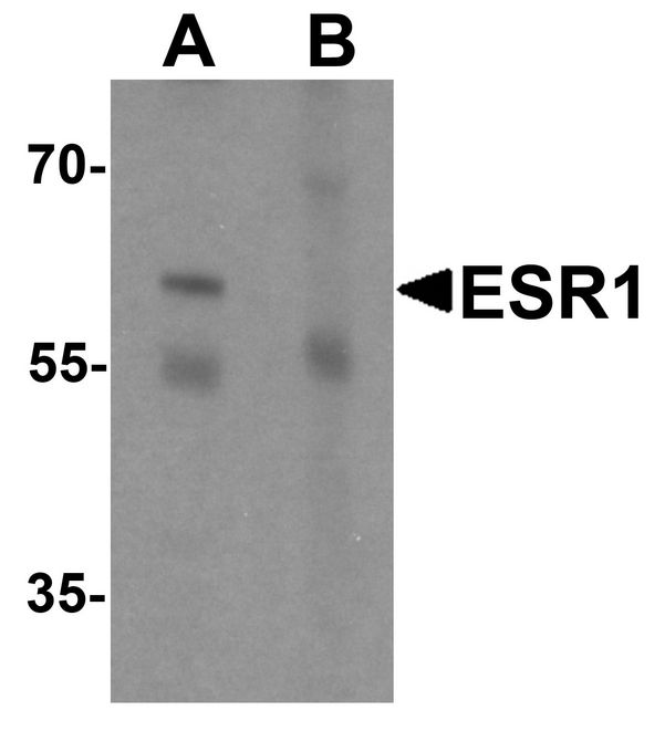 ER Alpha / Estrogen Receptor Antibody - Western blot analysis of ESR1 in rat brain tissue lysate with ESR1 antibody at 1 ug/ml in (A) the absence and (B) the presence of blocking peptide.