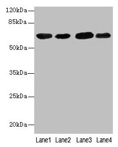 ER Alpha / Estrogen Receptor Antibody - Western blot All lanes: Estrogen receptor antibody at 7µg/ml Lane 1: Hela whole cell lysate Lane 2: MCF-7 whole cell lysate Lane 3: Rat brain tissue Lane 4: Colo320 whole cell lysate Secondary Goat polyclonal to rabbit IgG at 1/10000 dilution Predicted band size: 67, 54, 48, 36 kDa Observed band size: 67 kDa
